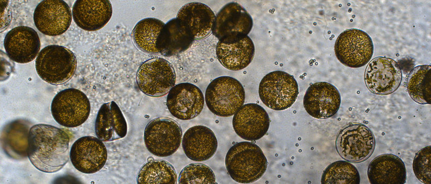 Max Planck Fellow Group Plankton Community Interaction Marine diatoms Coscinodiscus granii: They live in open waters such as the North Sea. Under the microscope, many single-celled diatoms can be seen, some of which are healthy, while others are infected by an egg fungus. The zoospores that the fungus forms for reproduction can be seen as small dots.