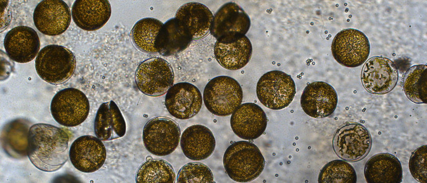 Max Planck Forschergruppe Interaktionen von Planktongemeinschaften Marine Kieselalgen Coscinodiscus granii: Sie leben in offenen Gewässern, wie der Nordsee. Unter dem Mikroskop sind viele einzellige Kieselalgen zu sehen, von denen einige gesund, andere hingegen von einem Eipilz infiziert sind. Die Zoosporen, die der Pilz zur Vermehrung ausbildet, sind als kleine Punkte zu sehen.