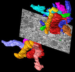 Reconstruction of neuronal profiles from ultrathin sections.