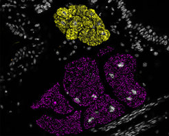 Localization of the two bacterial symbionts Shikimatogenerans bostrichidophilus (magenta) and Bostrichicola ureolyticus (yellow) in the powderpost beetle Dinoderus porcellus via Fluorescence in situ hybridization (FISH).
