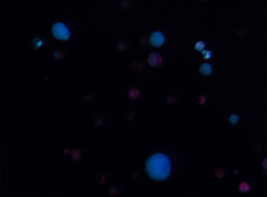 Protoplasten aus C. ipecacuanha-Blättern, UV-Mikroskopie.