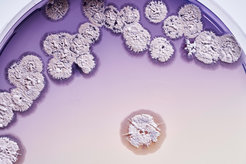 Bacteria of the species Streptomyces coelicolor on a petri dish